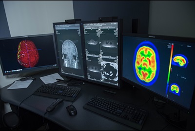 brain tumor diagnosis 